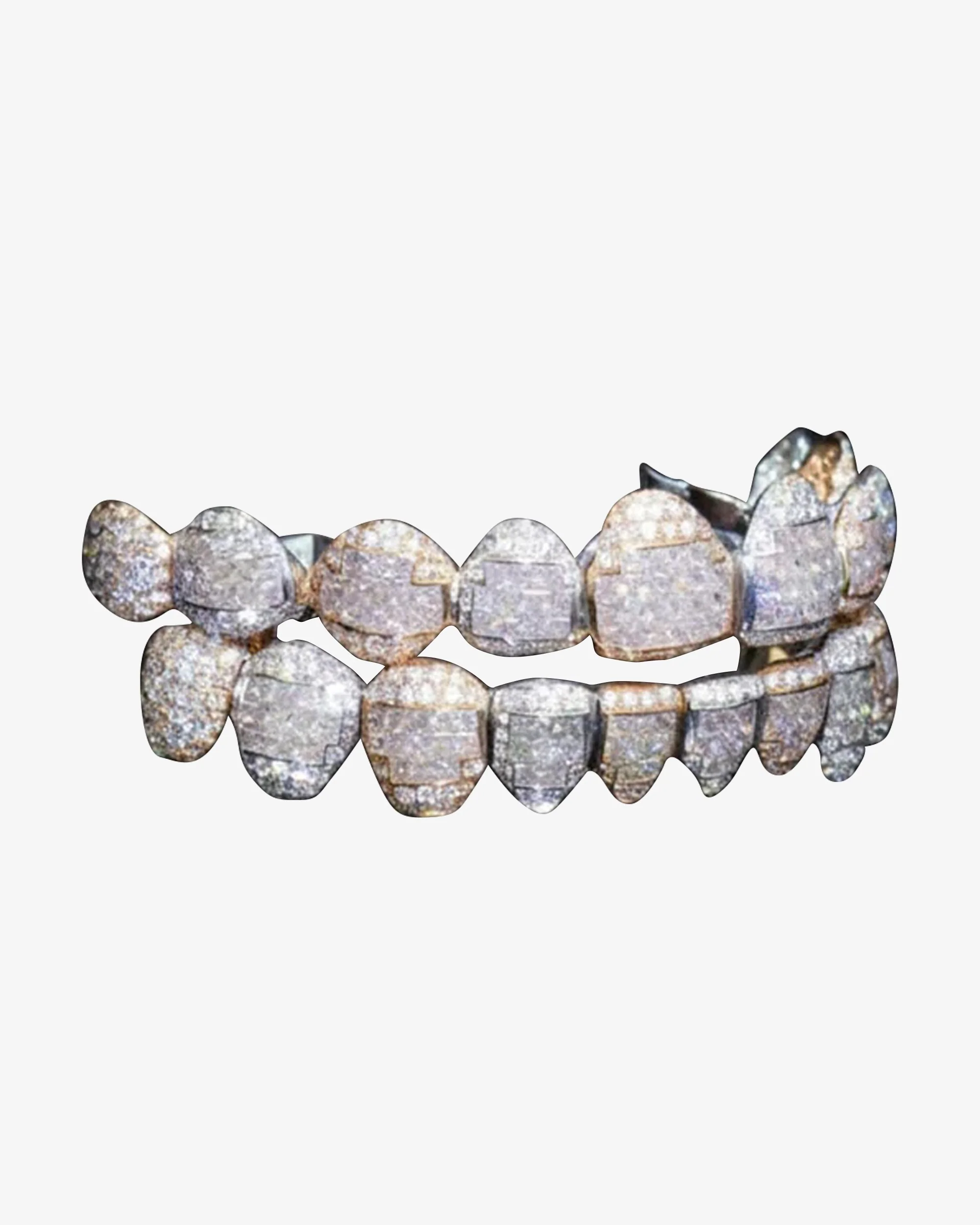 10 on 10 VVS Moissanite Diamond Grillz - Image 3