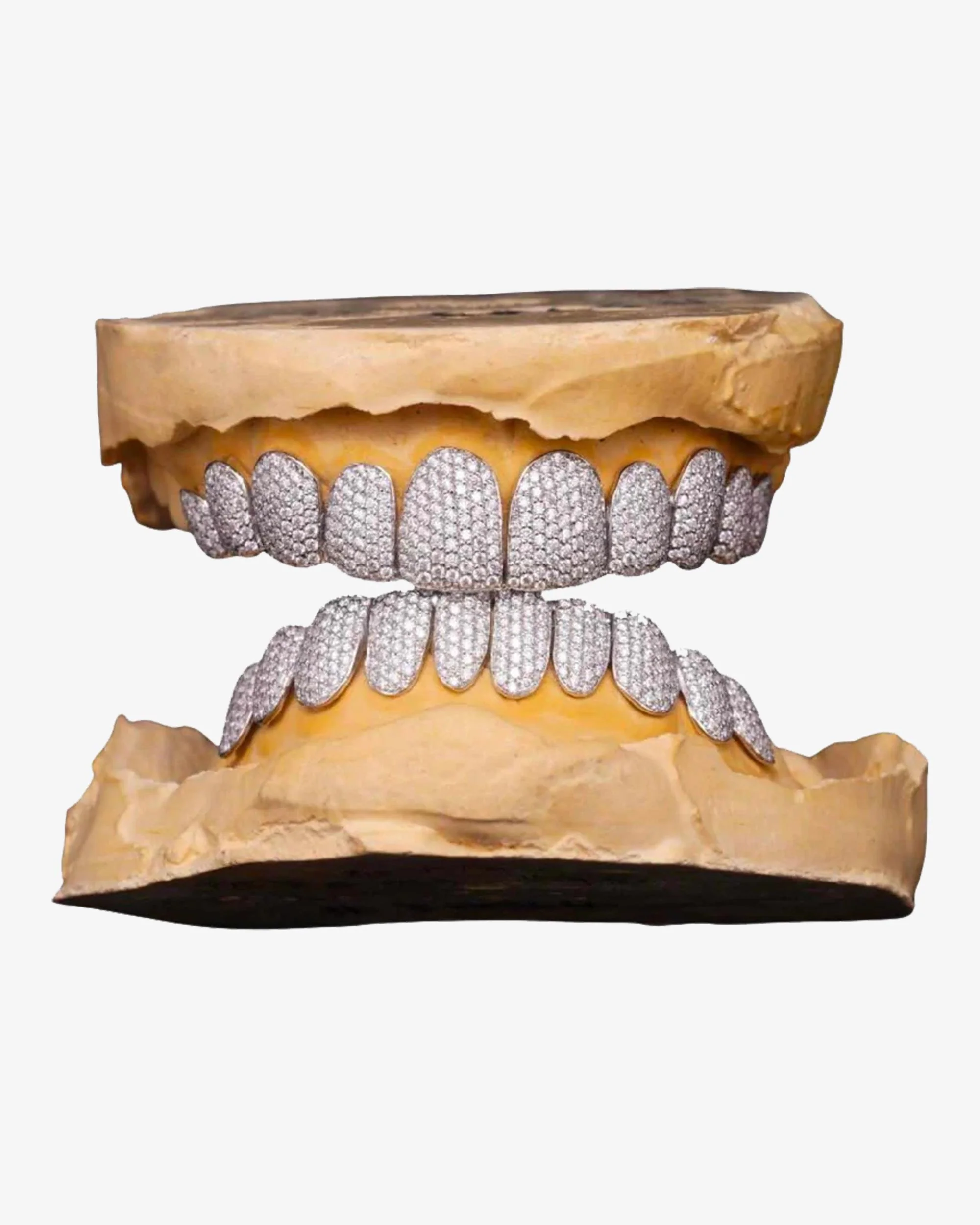 10 on 10 VVS Moissanite Prong Diamond Grillz - Image 3