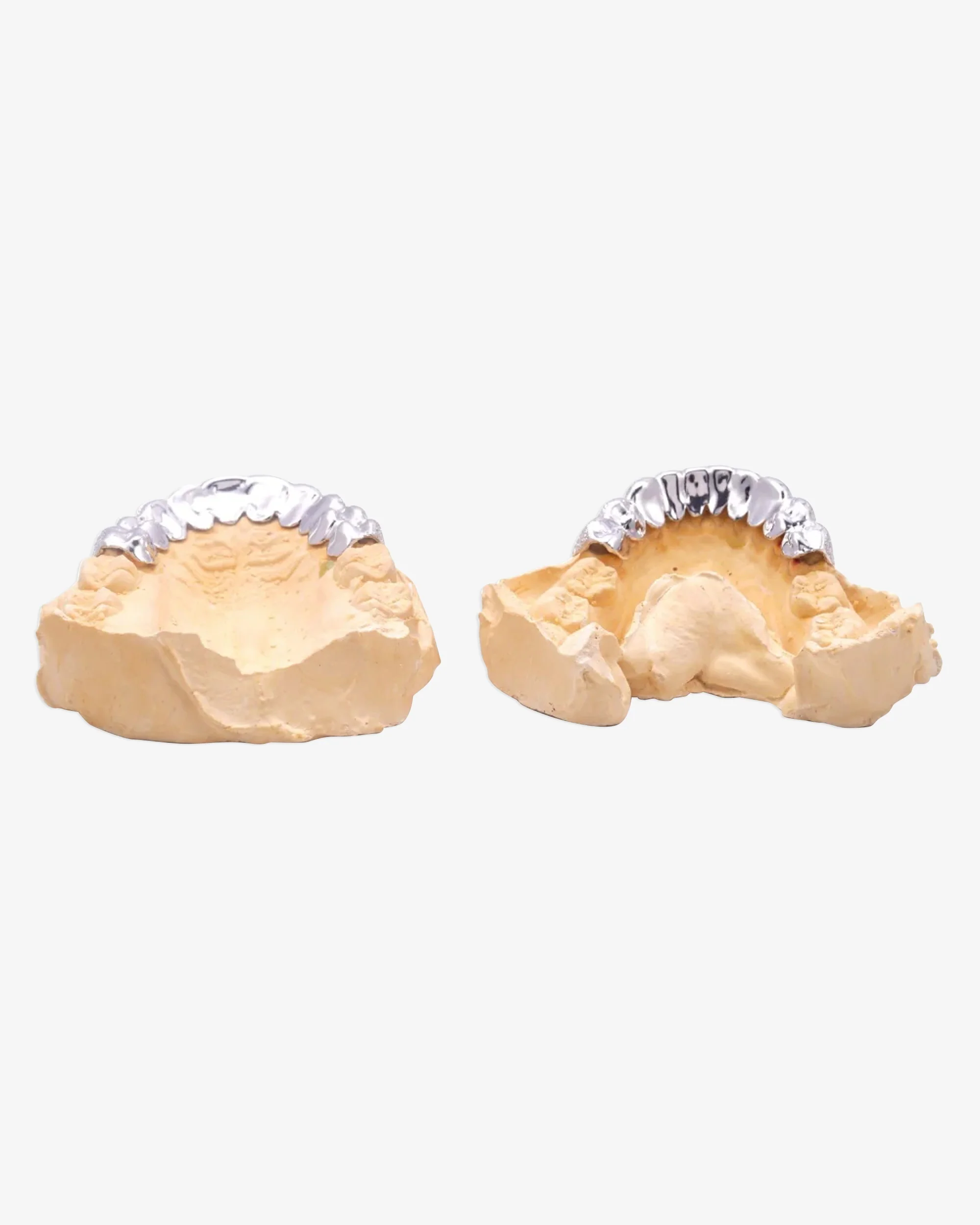 10 on 10 VVS Moissanite Prong Diamond Grillz - Image 6