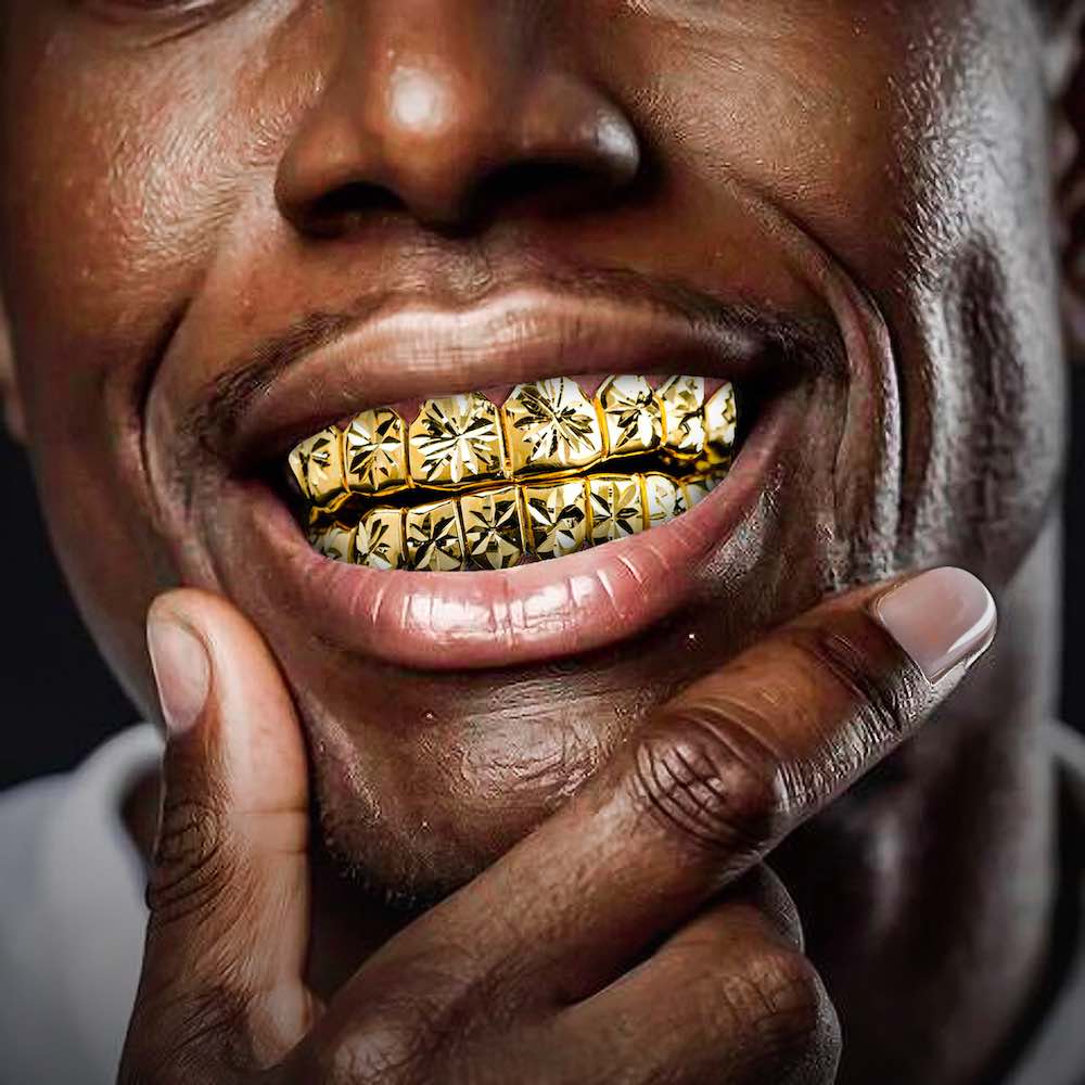 12 on 12 Starburst Grillz 14K Gold - Image 2