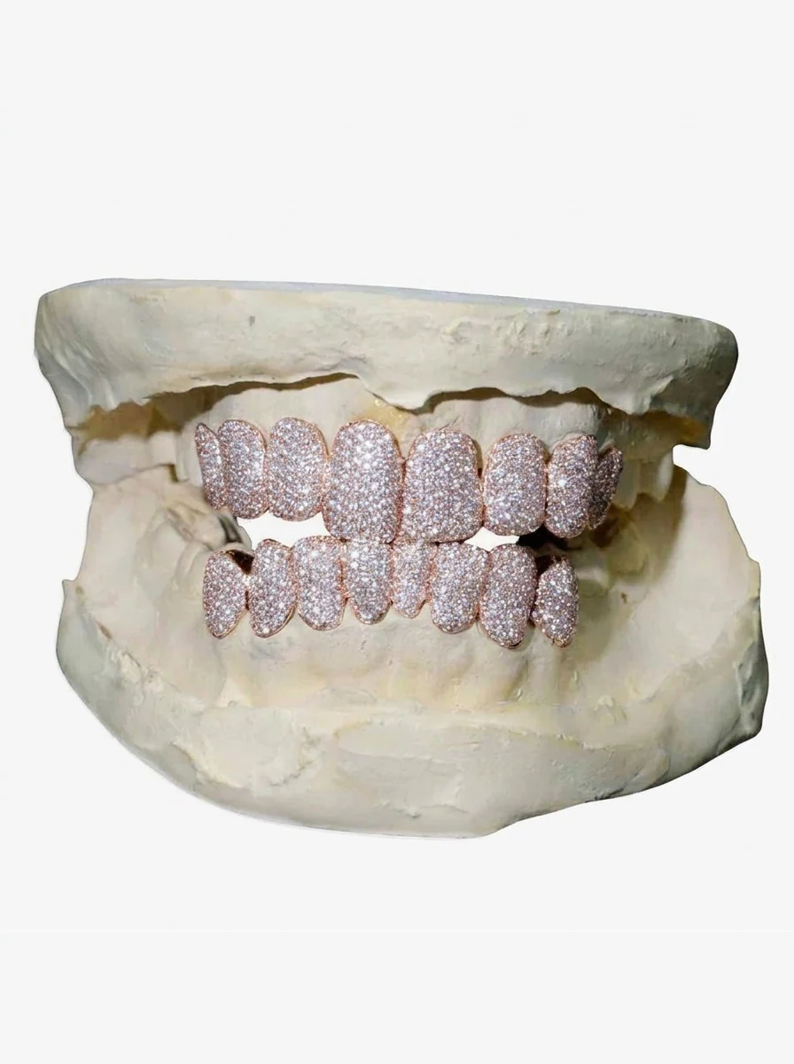 8 on 8 VVS Moissanite Diamond Grillz - Image 3