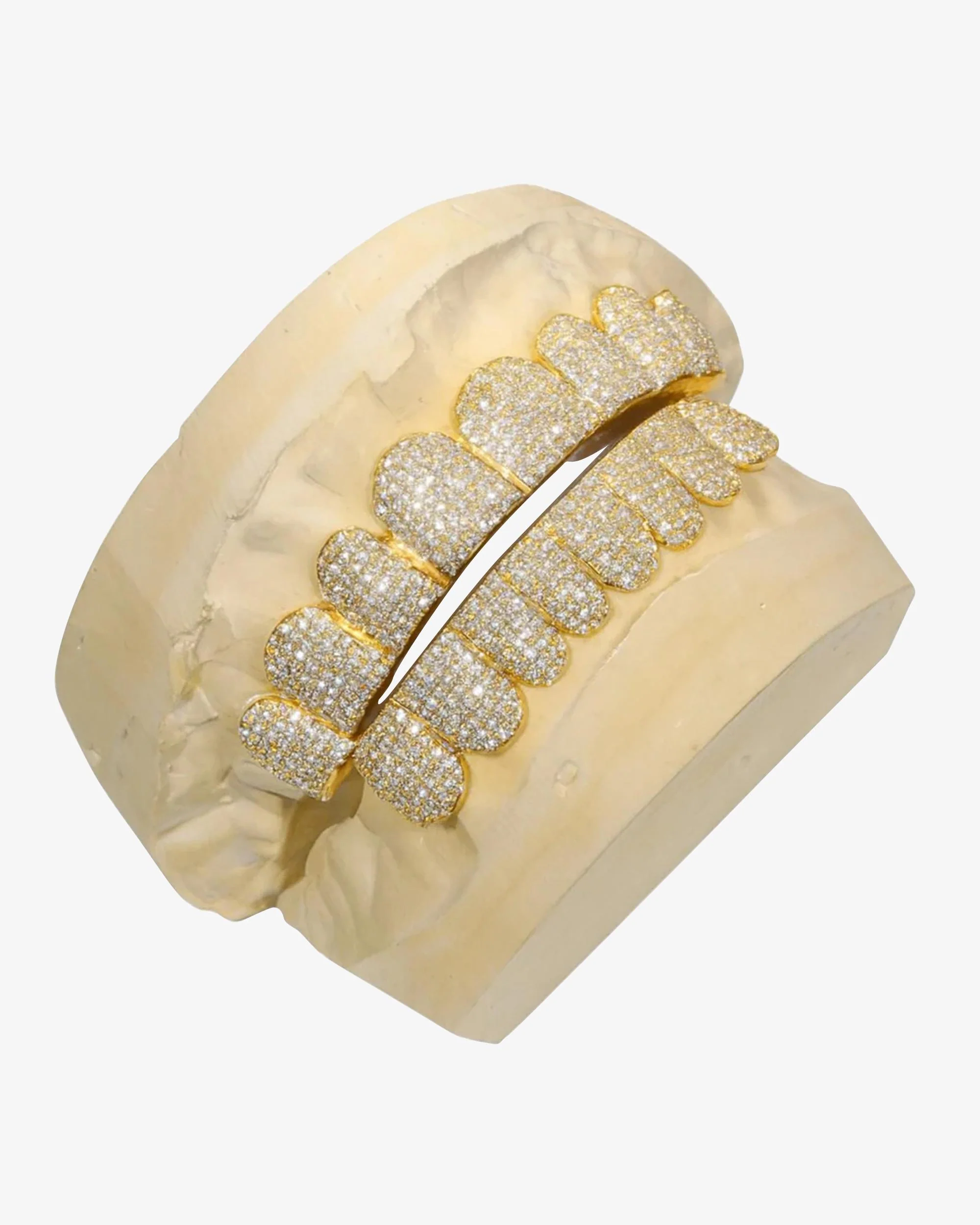 Custom Moissanite Diamond Grillz 14K Yellow Gold - Image 2
