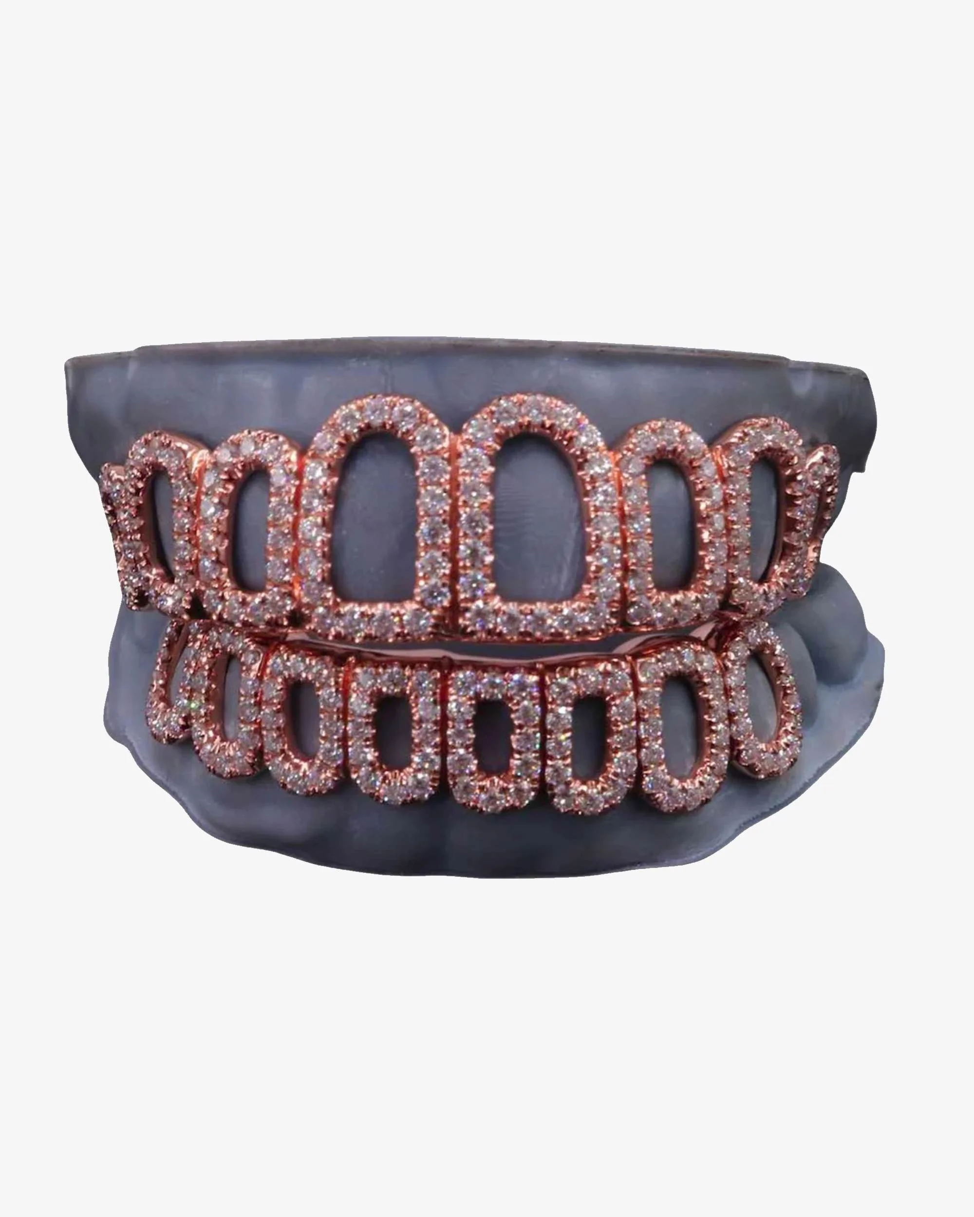 Rose Gold Open Face Custom Diamond Grillz